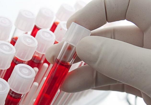 Blood test after drinking alcohol